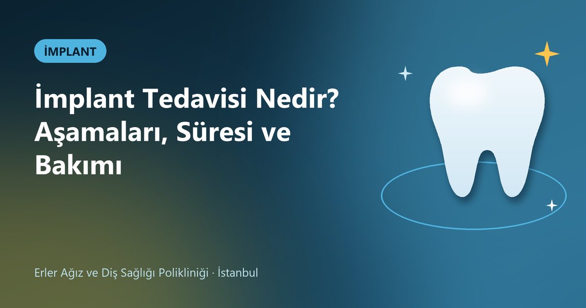 İmplant Tedavisi Nedir? Aşamaları, Süresi ve Bakımı – Erler Diş blog kapak görseli